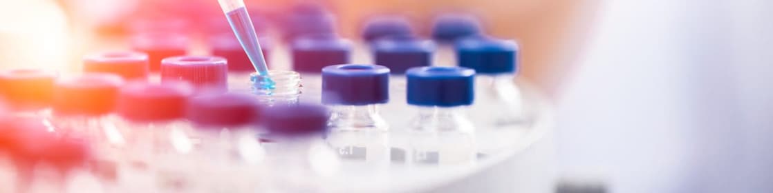 Liquid being poured into a plastic funnel by a shell scientist in a laboratory